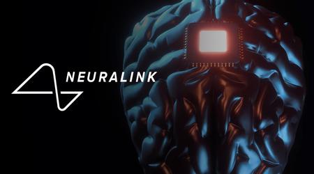 Det ikke-verbale mennesket er åpent for kommunikasjon: Neuralink har utført den tredje vellykkede operasjonen der en chip implanteres i hjernen til en pasient