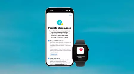 Apple Watch får kanadisk godkjenning for søvnapné-deteksjon
