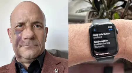 Slik bidro Apple Watch til å redde en syklists liv
