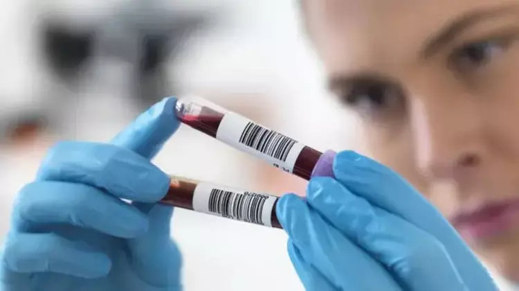 Kinesiske forskere utvikler AI-blodprøve som diagnostiserer ...