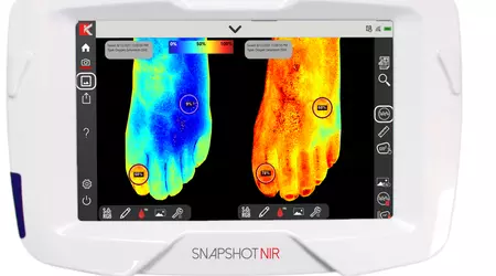 Bærbar diagnostisk enhet "Snapshot NIR" skal erstatte ultralyd og røntgen