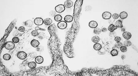 Australsk laboratorium går glipp av farlige virus på grunn av frysefeil