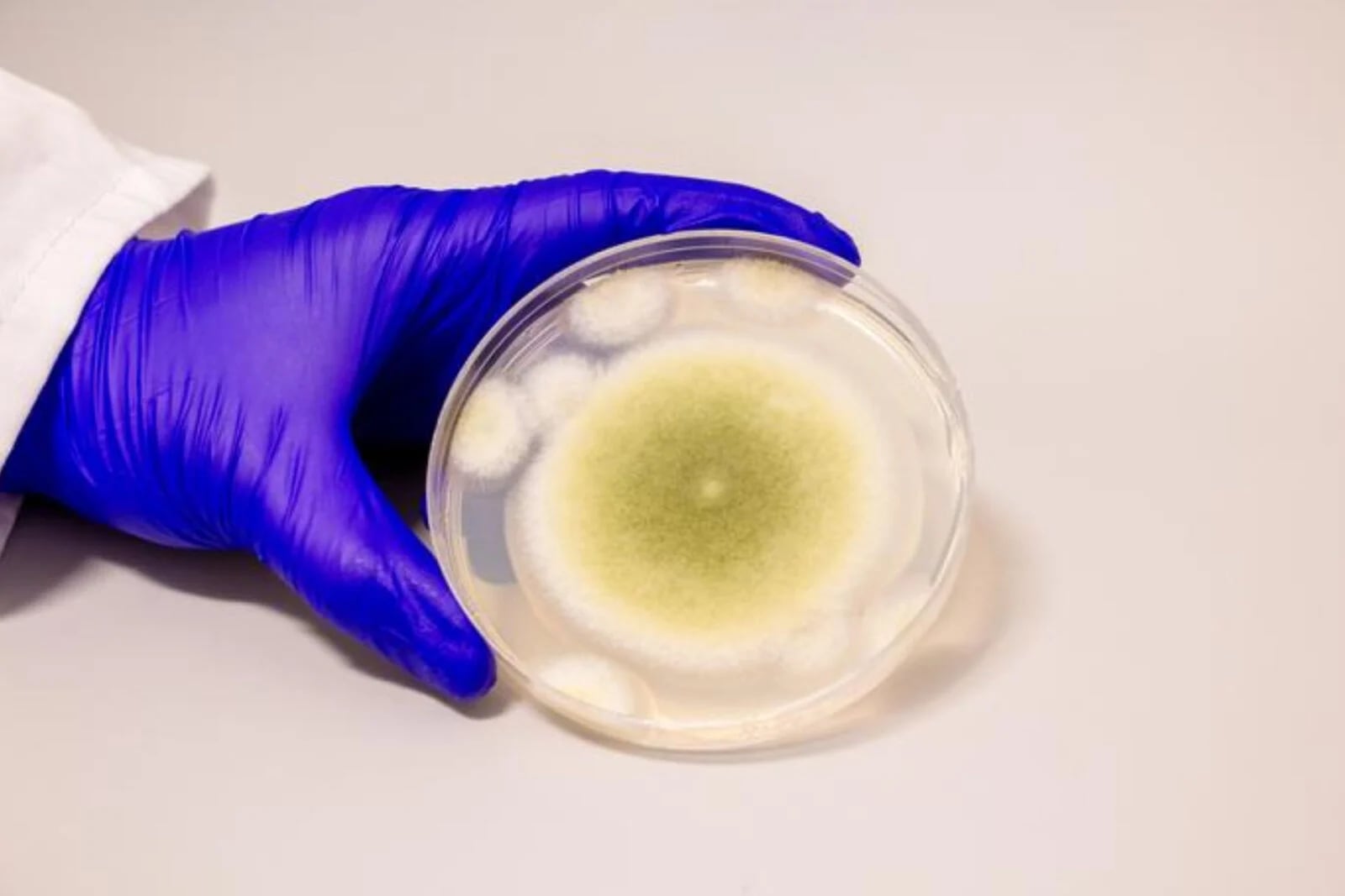 Aspergillus flavus: potensielle innovasjoner og helsefarer Aspergillus flavus: en sopp med teknologisk potensial og utfordringer